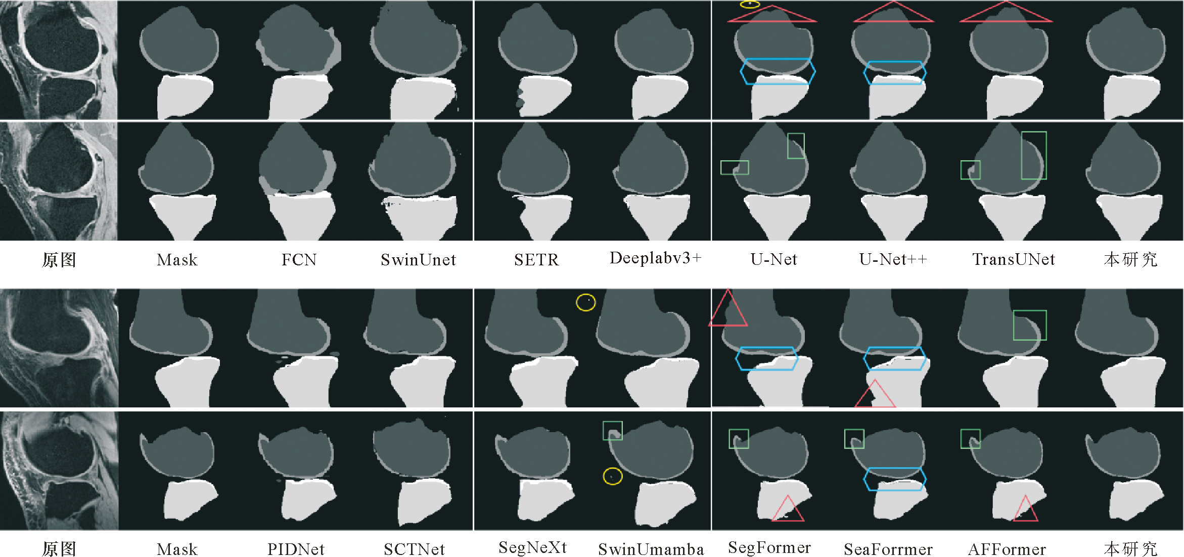 Construction and verification of segmentation model based on knee joint ...